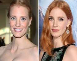 Jessica Chastain before surgery Jessica Chastain before surgery